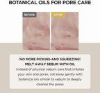  "SKIN1004 Madagascar Centella Light Cleansing Oil, a gentle makeup remover in a 200ml bottle."